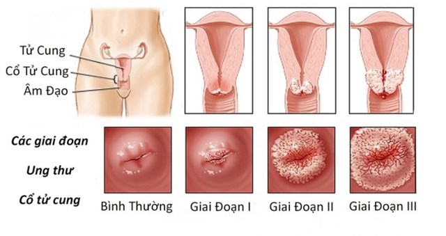 giai doan utctc