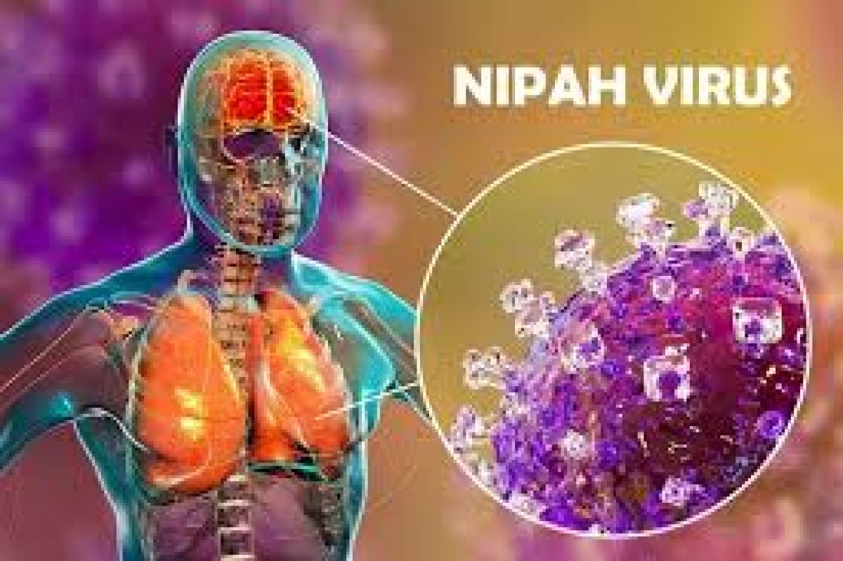 Tăng cường gi&aacute;m s&aacute;t, chủ động ph&ograve;ng chống bệnh do virus Nipah