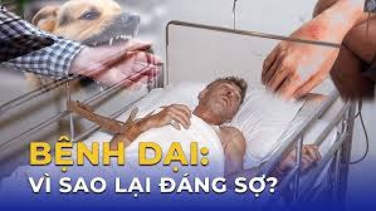 Những điều cần biết về bệnh Dại